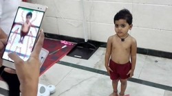 Ứng dụng theo dõi tình trạng suy dinh dưỡng bằng AI