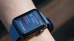 Đồng hồ thông minh Apple