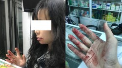 Chị N.D phản ánh bị tài xế Uber hành hung (ảnh nhân vật cung cấp)