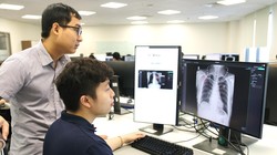 Dùng AI để phân tích ảnh X-quang phát hiện điểm bất thường