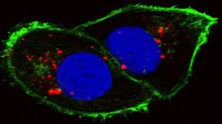 Tế bào ung thư thận (Ảnh Viện nghiên cứu ung thư quốc gia/Đại học Stanford)