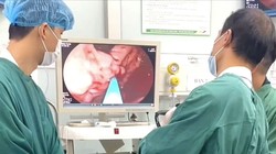 Người đàn ông bị xuất huyết tiêu hóa nguy kịch, bác sĩ chỉ ra nguyên nhân phổ biến