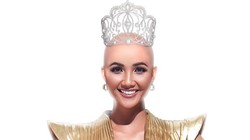 Quá lạ với hình ảnh hoa hậu H'Hen Niê không có tóc