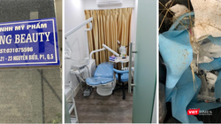 Bên dưới chung cư là biển hiệu “Công ty TNHH Mỹ phẩm Chang Beauty”, tại tầng 2 chung cư là cơ sở dịch vụ thẩm mỹ nhưng có chứng cứ của phẫu thuật thẩm mỹ trái phép (Ảnh: SYT) 