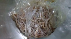 Búi giun to lấy ra khỏi cơ thể của V.