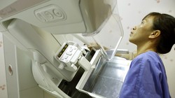 Bệnh nhân chụp Xquang vú tại Bệnh viện Bạch Mai