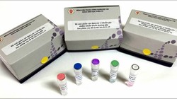 Bộ sinh phẩm mới vừa rẻ vừa chất lượng của nhóm bác sĩ Bệnh viện TWQĐ 108 (Ảnh: Hạnh Nguyên)