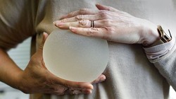 Túi nâng ngực có độ bền chắc, không bị vỡ vì áp suất trên máy bay (Ảnh: Getty Images)