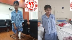 Nữ sinh U. đứng, tập đi lại sau khi được phẫu thuật.