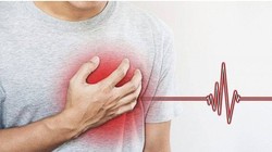 Bệnh nhồi máu cơ tim và đột quỵ thường bị nhầm lẫn, khiến cho việc điều trị, sơ cứu gặp khó khăn.