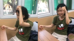 Sau mổ 4 tuần, khớp khuỷu của chị N đã có thể vận động rất tốt.