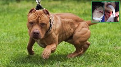 Một con chó Pitbull tấn công em bé 4 tuổi và mẹ, khiến các nạn nhân bị thương nặng, cấp cứu tới Bệnh viện Đa khoa Trung ương Thái Nguyên (Ảnh: BVCC + Internet)