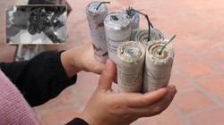 Tự chế pháo nổ, bàn tay của thiếu niên bị chấn thương nặng (Ảnh minh họa).