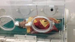 Cháu bé sinh non khi được khoảng 8 tháng và mới chỉ nặng 1,6kg.