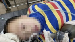 Bệnh nhi người Trung Quốc được cấp cứu tại Bệnh viện đa khoa Hải Dương tối 26/1. Ảnh: Báo Hải Dương