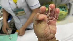 Chị H. cho rằng bác sĩ của Bệnh viện FV kê sai đơn thuốc khiến vết bỏng của con trai chị trở nặng - Ảnh: Chị H. cung cấp