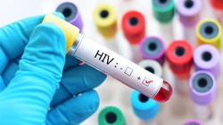 Nghiên cứu mới làm dấy lên hy vọng về một liệu pháp loại bỏ hoàn toàn virus HIV khỏi cơ thể người (Ảnh: Getty)