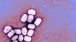 Bệnh đậu mùa từng khiến 500 triệu người chết trong thế kỷ 20 (Ảnh: Newsweek)