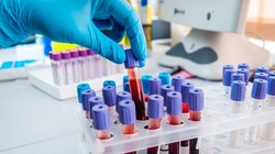 Hiện có hơn 100 loại bộ xét nghiệm kháng thể COVID-19 trôi nổi trên thị trường Mỹ (Ảnh: Live Science)