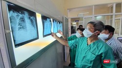 Các bác sĩ phân tích diễn biến của các bệnh nhân nặng.