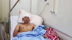 Bệnh nhân sau khi thực hiện ca phẫu thuật tái tạo lại dương vật.