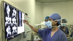 Các bác sĩ chẩn đoán tình hình bệnh nhân qua phim chụp Xquang. 