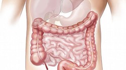 Đại tràng. Ảnh: Boldsky