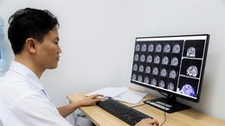 TS.BS. Nguyễn Đức Liên -Trưởng khoa Ngoại thần kinh, Bệnh viện K. 