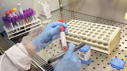 Phòng thí nghiệm chuẩn bị xét nghiệm Coronavirus. Ảnh: EPA-EFE