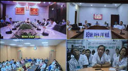 Các chuyên gia 3 miền hội chẩn trực tuyến để đưa ra chỉ định ghép phổi cho bệnh nhân 91. Ảnh: Lê Hảo 