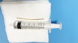 Chiếc tăm được lấy ra từ bụng bệnh nhân. (Ảnh: Bệnh viện Đại học Y Hà Nội)