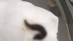 Con vắt dài 3 cm được lấy ra từ mũi bé trai 7 tuổi. (Ảnh: Bệnh viện Trương ương Quân đội 108)