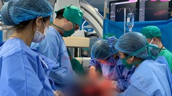 Các bác sĩ phẫu thuật cho sản phụ 42 tuổi bị rau tiền đạo, rau cài răng lược phức tạp (Ảnh: Bệnh viện Sản Nhi Quảng Ninh)