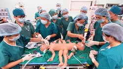 Gần 100 y, bác sĩ đang tiến hành phẫu thuật tách rời cặp song sinh Trúc Nhi – Diệu Nhi (Ảnh: Bệnh viện Nhi đồng Thành phố - TP. Hồ Chí Minh)