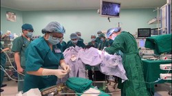 Bác sĩ phẫu thuật tách rời cặp song sinh dính liền (Ảnh: Bệnh viện Nhi đồng Thành phố - TP. Hồ Chí Minh) 