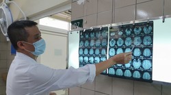 Bác sĩ xem phim chụp cộng hưởng từ sọ não của bệnh nhân bị nhiễm độc thiếc (Ảnh: Bệnh viện Bạch Mai) 