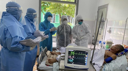 Các bác sĩ điều trị cho bệnh nhân nặng (Ảnh: BS. Lương Quốc Chính) 