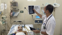 PGS.TS Đỗ Duy Cường thăm khám cho bệnh nhân tại Trung tâm Bệnh Nhiệt đới, Bệnh viện Bạch Mai (Ảnh: Mai Thanh) 