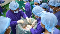 Bác sĩ phẫu thuật ghép phổi cho bệnh nhân Đ. (Ảnh: BVCC) 