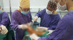 Các bác sĩ phẫu thuật cho bệnh nhân (Ảnh - BVCC) 