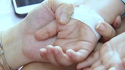 Trẻ mắc bệnh tay chân miệng có xu hướng gia tăng (Ảnh - Cục Y tế Dự phòng, BYT) 