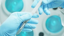 Ca phẫu thuật cấy ghép đầu được thực hiện thành công (ảnh minh họa).