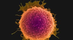 Đĩa nano có thể diệt các tế bào ung thư?