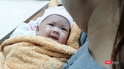 Hai bé song sinh dính liền gan tại Bệnh viện Nhi đồng 1 được xuất viện