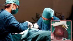 Lấy trọn khối u gan khổng lồ cứu sống bệnh nhân lớn tuổi