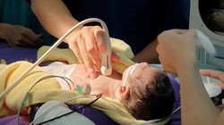 Cứu sống em bé có nguy cơ tử vong ngay từ khi lọt lòng. Ảnh: Internet
