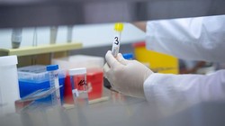 Thông tin mới nhất kết quả xét nghiệm 20 trường hợp đi trên chuyến bay VN0054 tại TP.HCM. Ảnh: CDC