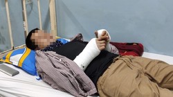 Một nạn nhân đang được điều trị tại BV Nhân dân Gia Định. Ảnh: BVCC