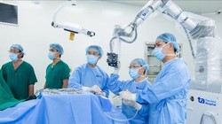 Mổ não bằng robot AI - cách mạng công nghệ trong y học