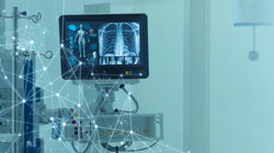 Công nghệ AI giúp việc chẩn đoán các bệnh về phổi trở nên dễ dàng và chính xác hơn (Ảnh: IE)